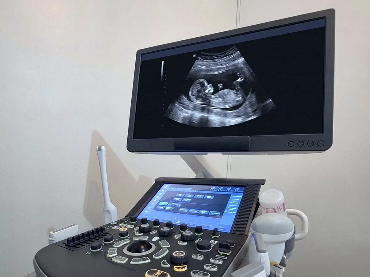 Monitor do aparelho de ultrassom da Lemede com imagem de exame obstétrico.